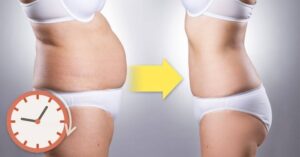 dos siluetas de mujer 'antes y después' de adelgazar con reloj a lado indicando el paso del tiempo